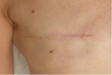 reparation-peau-isabelle-paelinck