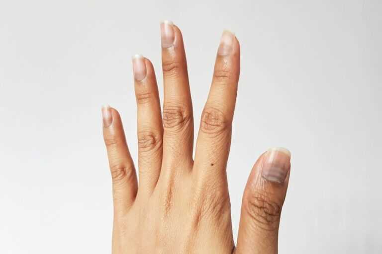 image 1 soin ongle